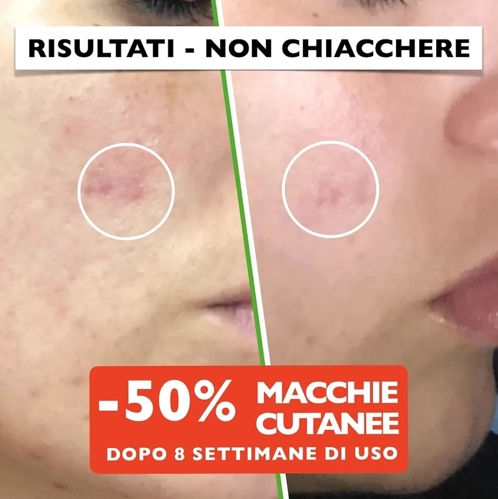 siero-antimacchia-con-Acido-Ialuronico